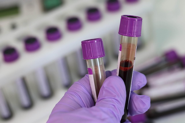 How to Prepare for Your First Hormone Lab Appointment